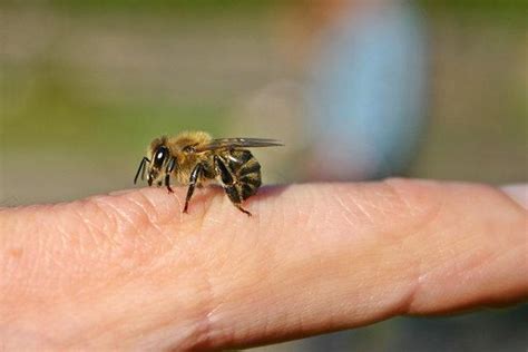 parmaktan arı sokması